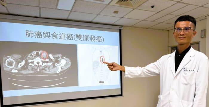 喜饮烈酒与抽烟 近七旬台商罹双癌