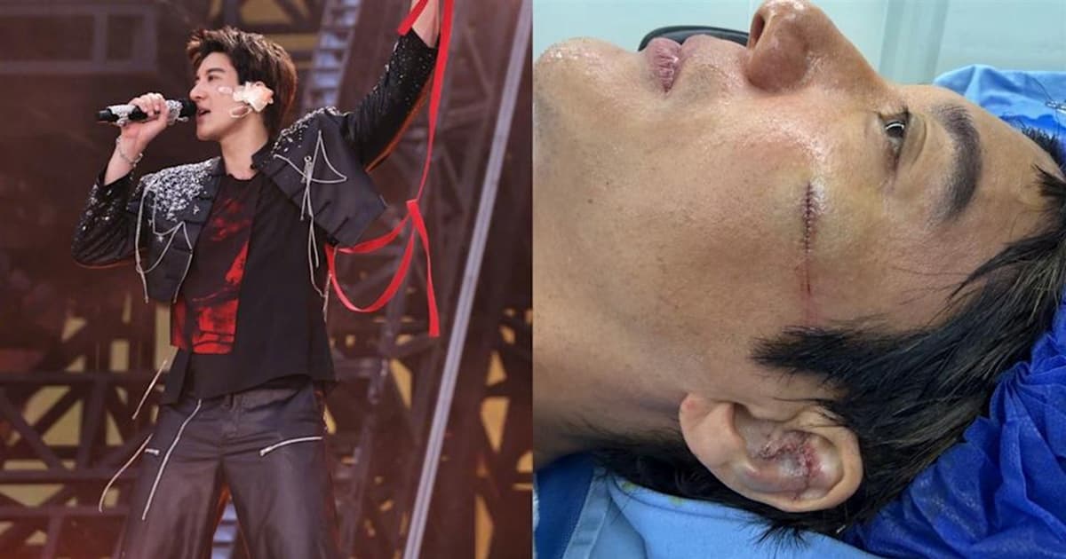 王力宏成都演唱會濺血 撞碎左耳臉縫39針(視頻)